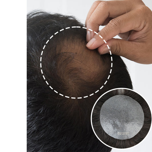 Crown Patch - 100% Human Hair Super Soft V-loop Thin Skin PU Base