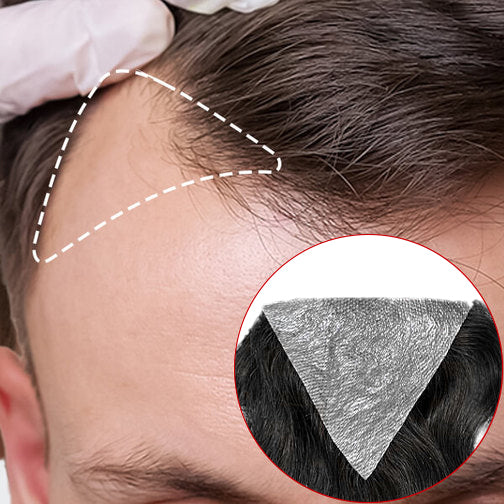 Temple Patch (2 Pieces) - 100% Human Hair Super Soft V-loop Thin Skin PU Base