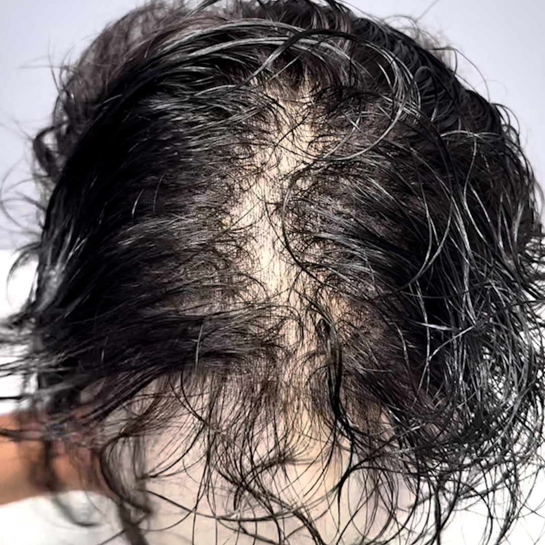 70% Ultra-light Density V-Loop 0.03mm Skin Base Men hair system